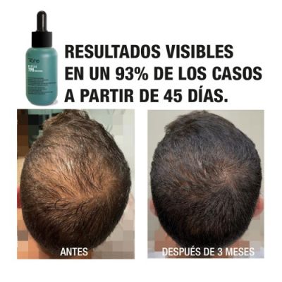 Anti-hair loss concentrate Peptide T98 (50 ml) TAHE